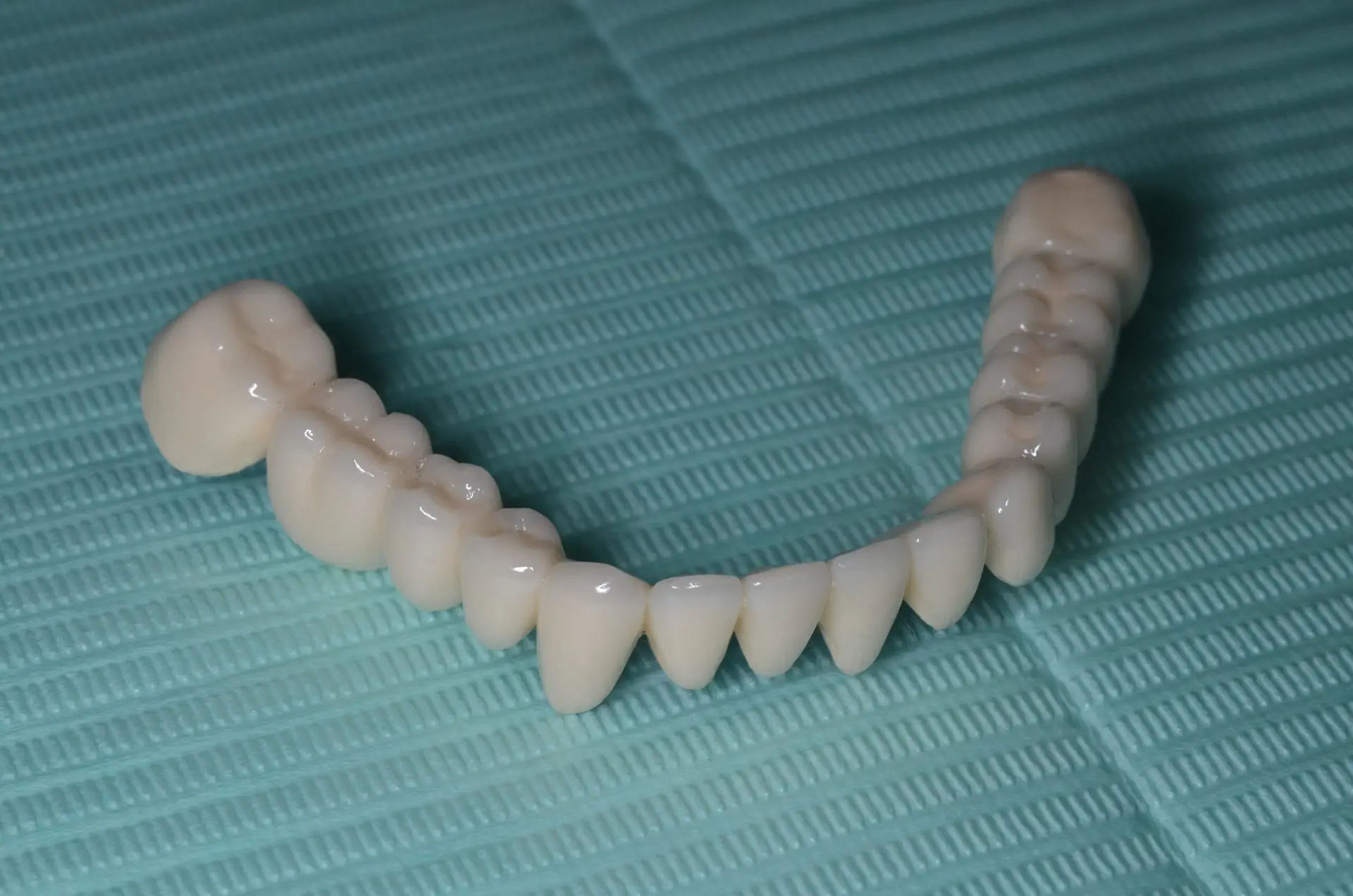 dental prothese sur implants